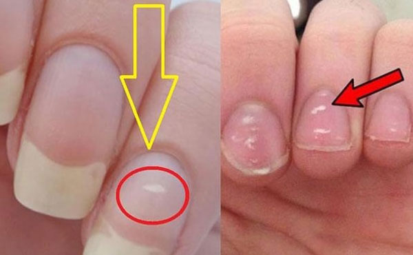 3 months of regular manicures before and after